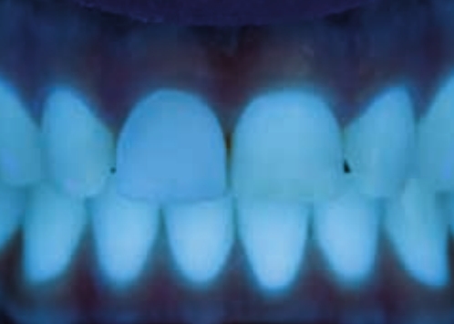 Флуоресценция Luxatemp Fluorescence